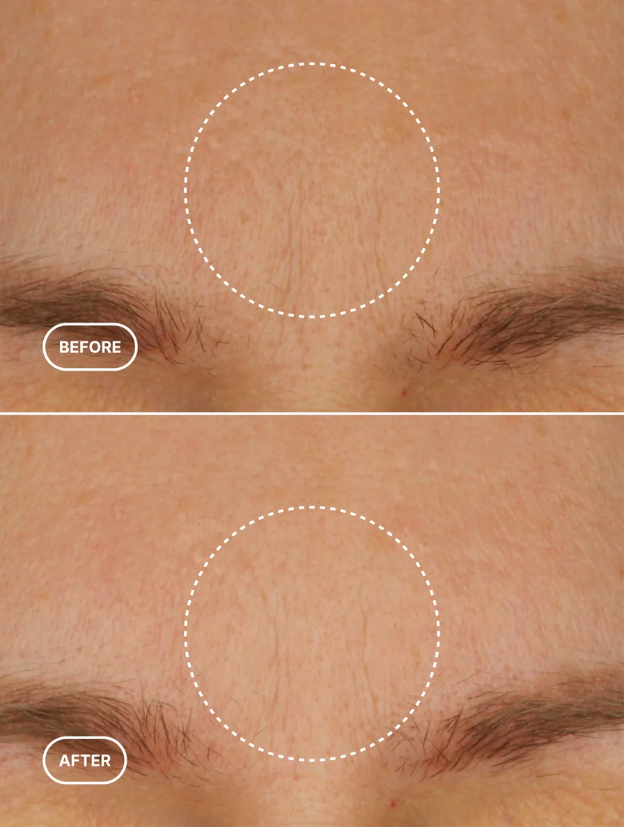 Retinol-Alternative Feuchtigkeitscreme