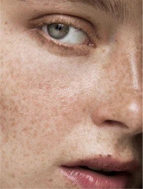 Pigment Perfektionierendes Serum